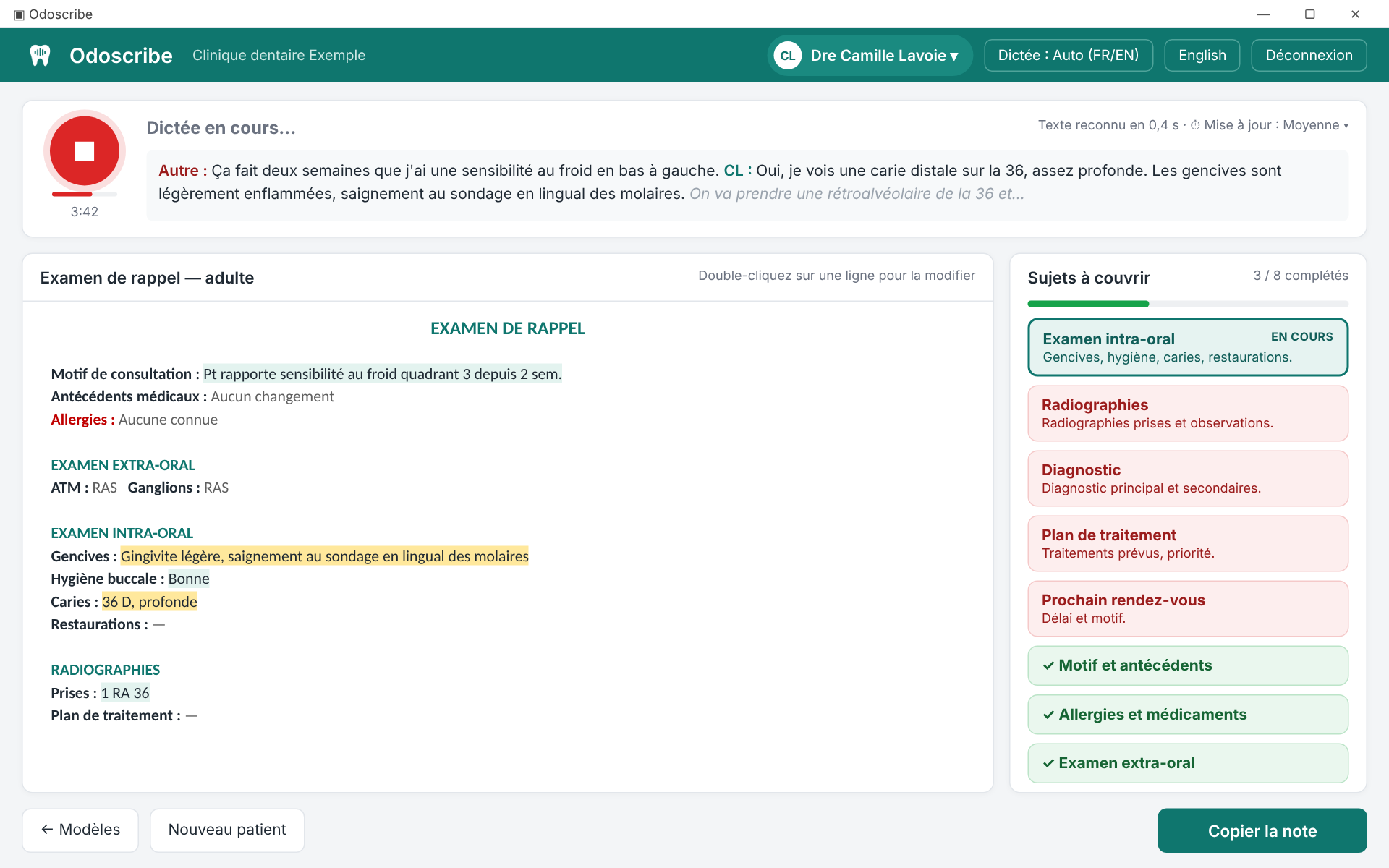 Écran d'examen Odoscribe : transcription en direct, note remplie et liste de sujets